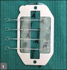 The Zip Surgical Skin Closure device