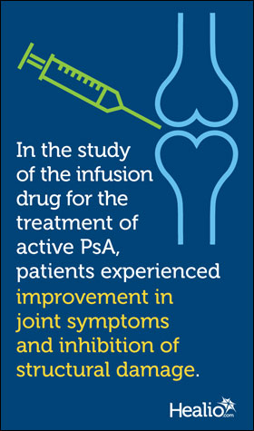 Infusion graphic