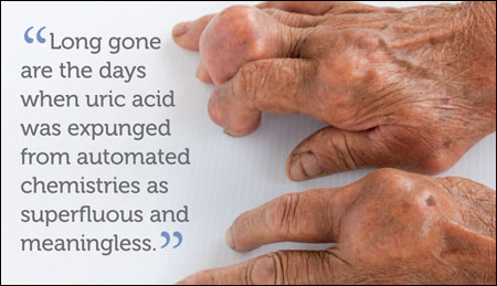 Uric acid graphic