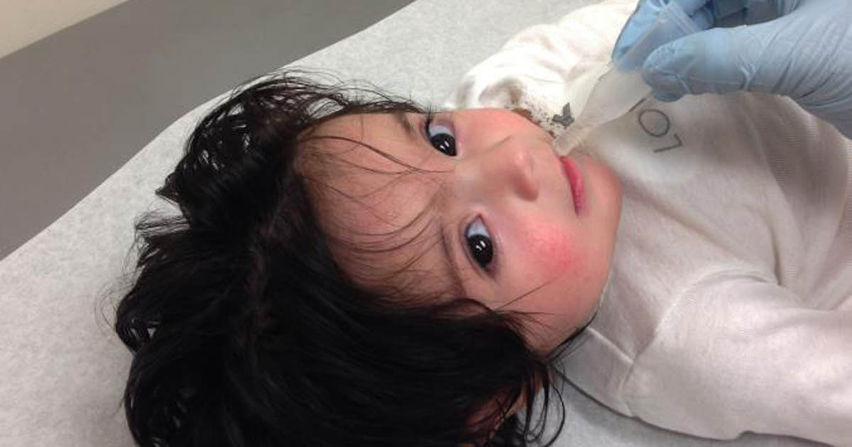 Infant receiving oral vaccine