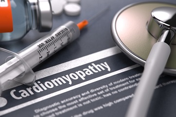 cardiomyopathy